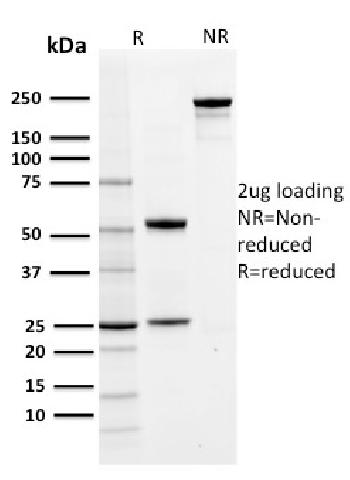 Anti-PD-L1 / PDCD1LG1 / CD274 / B7-H1 (Cancer Immunotherapy Target) Monoclonal Antibody(Clone: PDL1/2742)