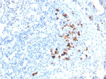 Anti-IgA Monoclonal Antibody(Clone: HISA43)