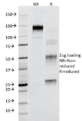 Anti-CD95 / FAS / TNFRSF6 Monoclonal Antibody(Clone: B-R18)