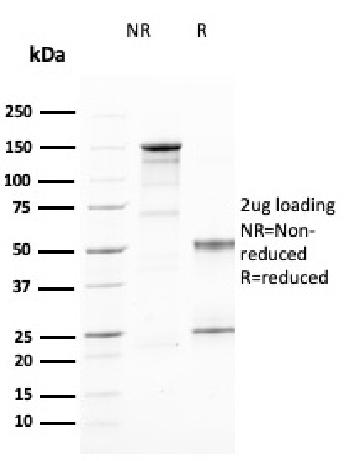 Anti-CD25 / IL2RA (Activated Lymphocyte Marker) Monoclonal Antibody(Clone: IL2RA/2394)