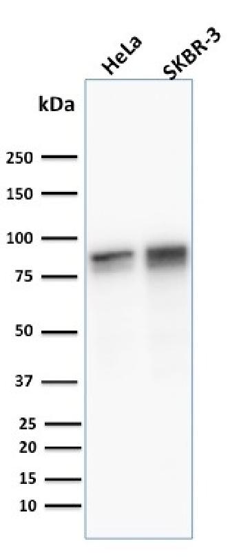 Anti-Catenin, gamma (Cardiomyocyte Marker) Monoclonal Antibody(Clone: 11E4)