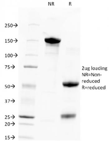 Anti-TACSTD2 / TROP2 (Epithelial Marker) Monoclonal Antibody(Clone: TACSTD2/2151)