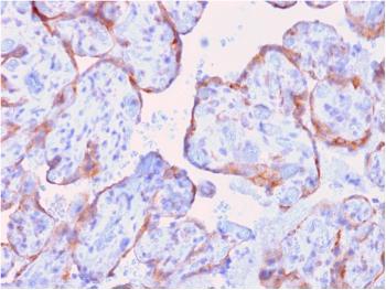 Anti-MMP3 (Marker of Metastasis and Rheumatoid Arthritis) Monoclonal Antibody(Clone: rMMP3/1730) Anti-MMP3 (Marker of Metastasis and Rheumatoid Arthritis) Monoclonal Antibody(Clone: rMMP3/1730)
