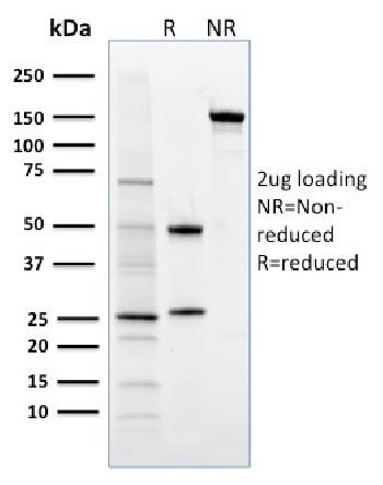Anti-FOXP3 (Forkhead Box Protein P3) / Scurfin Monoclonal Antibody(Clone: 3G3)