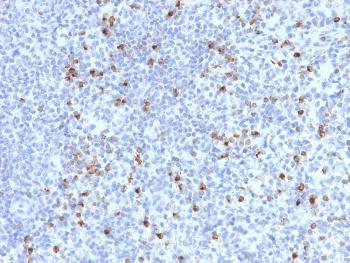 Anti-Perforin-1 (Pore Forming Protein) (Apoptosis Marker) Monoclonal Antibody(Clone: PRF1/2470)
