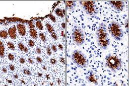Fig: 2 Immunohistochemical analysis of Gastric Mucin in human stomach using Gastric Mucin antibody (Clone: 45M1) at 1:500 dilution.