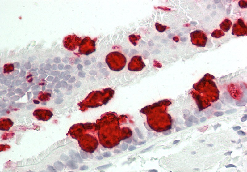 Monoclonal Antibody to Gastric Mucin (Clone: 45M1)