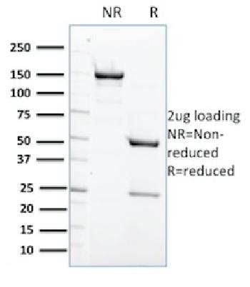 Anti-Protein Tyrosine Phosphatase, non-receptor type 6 Monoclonal Antibody(Clone: CPTC-PTPN6-2)