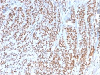 Anti-Rb1 (Tumor Suppressor Protein) Monoclonal Antibody(Clone: 1F8)
