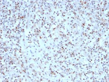 Anti-Bcl-6 (Follicular Lymphoma Marker) Monoclonal Antibody(Clone: rBCL6/1527) Anti-Bcl-6 (Follicular Lymphoma Marker) Monoclonal Antibody(Clone: rBCL6/1527)