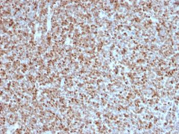 Anti-Bcl-6 (Follicular Lymphoma Marker) Monoclonal Antibody(Clone: BCL6/1527) BSA/Azide Free
