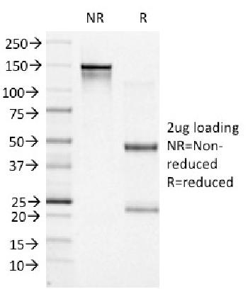 Fig. 4: SDS-PAGE Analysis Purified BCL-6 Mouse Monoclonal Antibody (BCL6/1527). Confirmation of Integrity and Purity of Antibody.