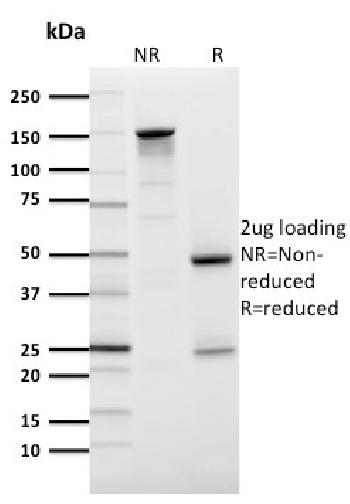 hpv mesothelioma