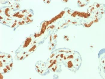 Anti-Spectrin Alpha 1 (Erythrocyte Marker) Monoclonal Antibody(Clone: SPTA1/1832)