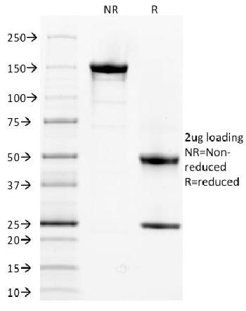Anti-Spectrin Alpha 1 (Erythrocyte Marker) Monoclonal Antibody(Clone: SPTA1/1832)