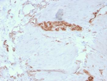 Anti-Fodrin / Alpha Spectrin II (SPTAN1) / NEAS Monoclonal Antibody(Clone: SPTAN1/3351)