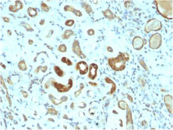 Anti-STAT3 / Signal Transducer and Activator of Transcription 3 Monoclonal Antibody(Clone: STAT3/2409)