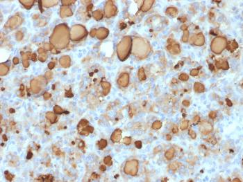 Anti-Thyroglobulin (Thyroidal Cell Marker) Monoclonal Antibody(Clone: rTGB24) Anti-Thyroglobulin (Thyroidal Cell Marker) Monoclonal Antibody(Clone: rTGB24)