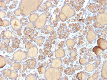 Anti-Thyroglobulin (Thyroidal Cell Marker) Monoclonal Antibody(Clone: r6E1) Anti-Thyroglobulin (Thyroidal Cell Marker) Monoclonal Antibody(Clone: r6E1)