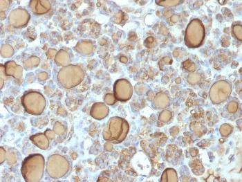 Anti-Thyroglobulin (Thyroidal Cell Marker) Monoclonal Antibody(Clone: TGB/1970R) Anti-Thyroglobulin (Thyroidal Cell Marker) Monoclonal Antibody(Clone: TGB/1970R)