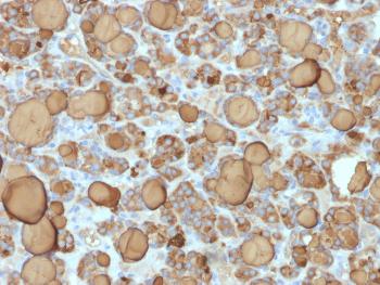 Anti-Thyroglobulin (Thyroidal Cell Marker) Monoclonal Antibody(Clone: TGB/1968R) Anti-Thyroglobulin (Thyroidal Cell Marker) Monoclonal Antibody(Clone: TGB/1968R)