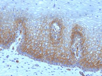 Anti-Thrombomodulin / CD141 (Endothelial Cell Marker) Monoclonal Antibody(Clone: rTHBD/1591) Anti-Thrombomodulin / CD141 (Endothelial Cell Marker) Monoclonal Antibody(Clone: rTHBD/1591)