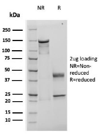 Anti-TIMP1 (Colorectal Cancer Biomarker / Marker of Lymph Node Metastasis) Monoclonal Antibody(Clone: rTIMP1/1710) Anti-TIMP1 (Colorectal Cancer Biomarker / Marker of Lymph Node Metastasis) Monoclonal Antibody(Clone: rTIMP1/1710)