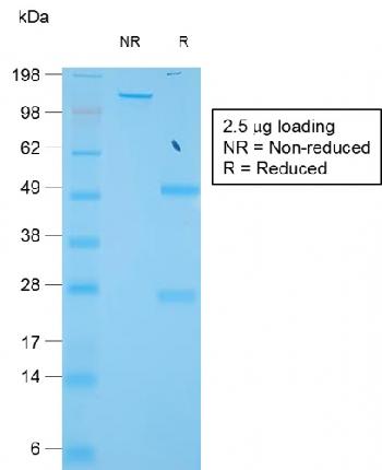 Anti-TIMP1 (Colorectal and Lymph Node Metastasis Marker) Monoclonal Antibody(Clone: TIMP1/1944R) Anti-TIMP1 (Colorectal and Lymph Node Metastasis Marker) Monoclonal Antibody(Clone: TIMP1/1944R)