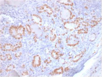 Anti-TTF-1 / NKX2.1 (Thyroid & Lung Epithelial Marker) Monoclonal Antibody(Clone: rNX2.1/690) Anti-TTF-1 / NKX2.1 (Thyroid & Lung Epithelial Marker) Monoclonal Antibody(Clone: rNX2.1/690)