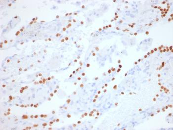Anti-TTF-1 / NKX2.1 (Thyroid & Lung Epithelial Marker) Monoclonal Antibody(Clone: NX2.1/1855R) Anti-TTF-1 / NKX2.1 (Thyroid & Lung Epithelial Marker) Monoclonal Antibody(Clone: NX2.1/1855R)