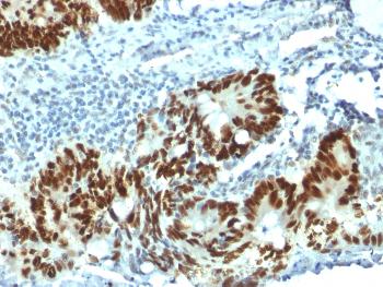Anti-p53 Tumor Suppressor Protein Monoclonal Antibody(Clone: PAb1801)