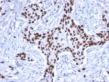 Anti-p53 Tumor Suppressor Protein Monoclonal Antibody(Clone: rTP53/1739)