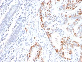 Anti-p53 Tumor Suppressor Protein Monoclonal Antibody(Clone: rBP53-12) Anti-p53 Tumor Suppressor Protein Monoclonal Antibody(Clone: rBP53-12)