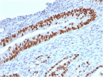 Anti-p53 (Tumor Suppressor Protein) Monoclonal Antibody(Clone: TP53/2719)