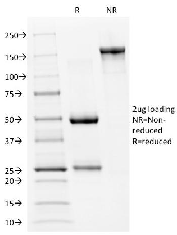 Anti-p53 Tumor Suppressor Protein Monoclonal Antibody(Clone: PAb240)