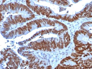 Anti-p53 Tumor Suppressor Protein Monoclonal Antibody(Clone: TP53/1739) Anti-p53 Tumor Suppressor Protein Monoclonal Antibody(Clone: TP53/1739)