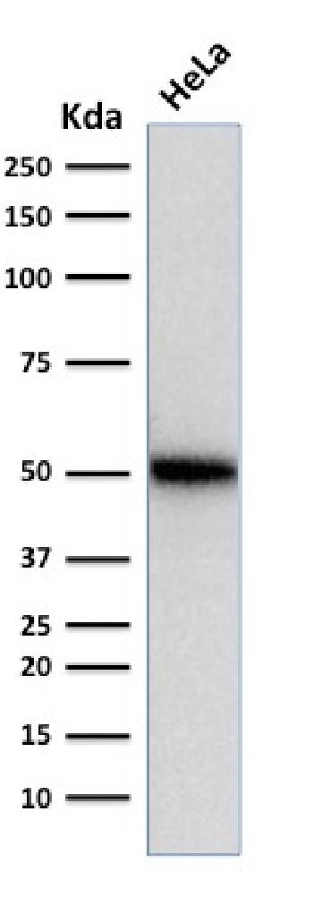 Anti-p53 Tumor Suppressor Protein Monoclonal Antibody(Clone: SPM514)
