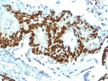 Anti-p53 Tumor Suppressor Protein Monoclonal Antibody(Clone: TP53/1799R)