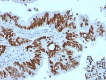 Anti-p53 Tumor Suppressor Protein Monoclonal Antibody(Clone: TP53/2092R) Anti-p53 Tumor Suppressor Protein Monoclonal Antibody(Clone: TP53/2092R)