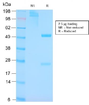 Anti-p53 Tumor Suppressor Protein Monoclonal Antibody(Clone: TP53/3156R)
