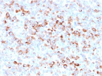 Anti-Tyrosinase (Melanoma Marker) Monoclonal Antibody(Clone: rOCA1/812) Anti-Tyrosinase (Melanoma Marker) Monoclonal Antibody(Clone: rOCA1/812)