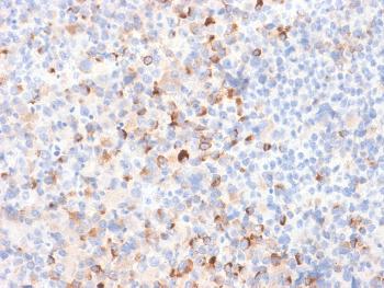 Anti-Tyrosinase (Melanoma Marker) Monoclonal Antibody(Clone: TYR/2024R) Anti-Tyrosinase (Melanoma Marker) Monoclonal Antibody(Clone: TYR/2024R)