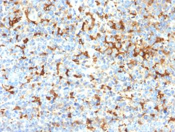 Anti-Tyrosinase-Related Protein-1 (TYRP-1) (Melanoma Marker) Monoclonal Antibody(Clone: TYRP1/2340R) Anti-Tyrosinase-Related Protein-1 (TYRP-1) (Melanoma Marker) Monoclonal Antibody(Clone: TYRP1/2340R)