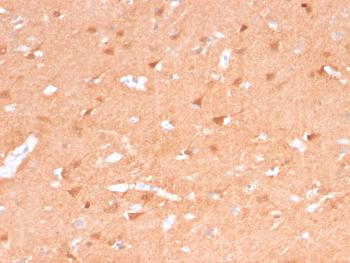 Anti-PGP9.5 / UchL1 (pan-Neuronal Marker) Monoclonal Antibody(Clone: rUCHL1/775) Anti-PGP9.5 / UchL1 (pan-Neuronal Marker) Monoclonal Antibody(Clone: rUCHL1/775)