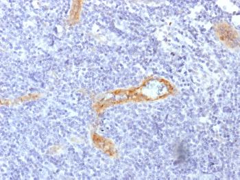 Anti-von Willebrand Factor / Factor VIII Related-Ag (Endothelial Marker) Monoclonal Antibody(Clone: rVWF/1465) Anti-von Willebrand Factor / Factor VIII Related-Ag (Endothelial Marker) Monoclonal Antibody(Clone: rVWF/1465)