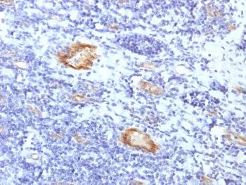 Anti-von Willebrand Factor / Factor VIII Related-Ag (Endothelial Marker) Monoclonal Antibody(Clone: VWF/1859R) Anti-von Willebrand Factor / Factor VIII Related-Ag (Endothelial Marker) Monoclonal Antibody(Clone: VWF/1859R)