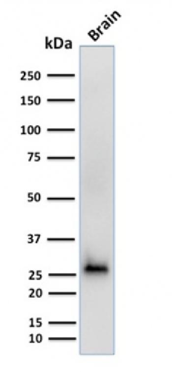 what happens if you test asymptomatic for covid 19