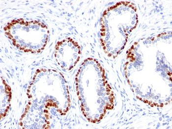 Anti-p63 (Squamous, Basal & Myoepithelial Cell Marker) Monoclonal Antibody(Clone: TP63/1423R) Anti-p63 (Squamous, Basal & Myoepithelial Cell Marker) Monoclonal Antibody(Clone: TP63/1423R)