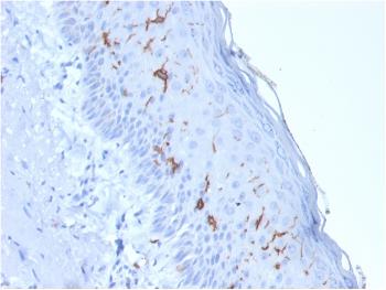 Anti-CD1a / HTA1 (Mature Langerhans Cells Marker) Monoclonal Antibody(Clone: rC1A/711) Anti-CD1a / HTA1 (Mature Langerhans Cells Marker) Monoclonal Antibody(Clone: rC1A/711)