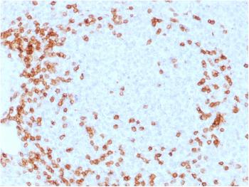 Anti-CD3e (T-Cell Marker) Monoclonal Antibody(Clone: C3e/1931)